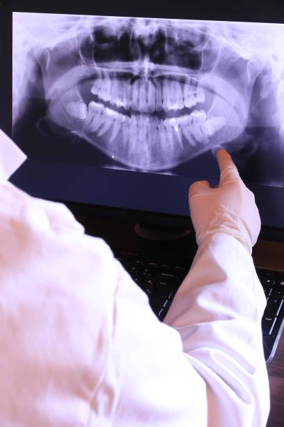 Best Emergency Dental Surgery in Haledon, NJ