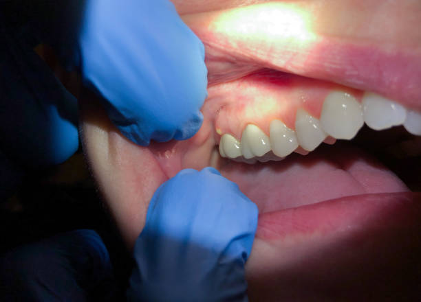 Best Emergency Treatment for Toothache in Haledon, NJ